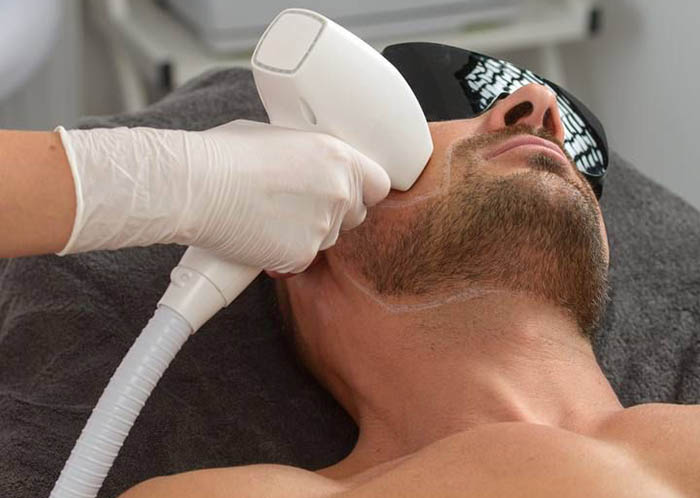 لیزر موهای زائد در اسلامشهر