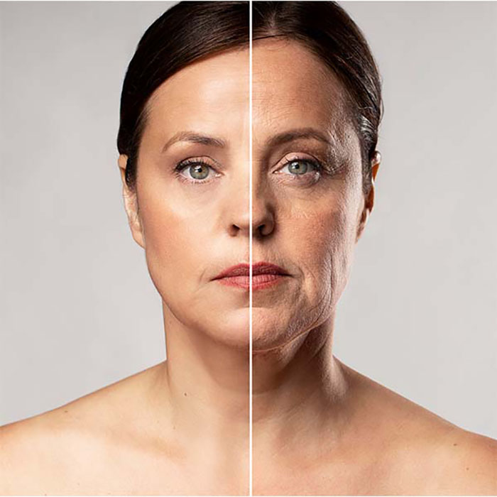 هایفو در کلینیک زیبایی رویال اسلامشهر