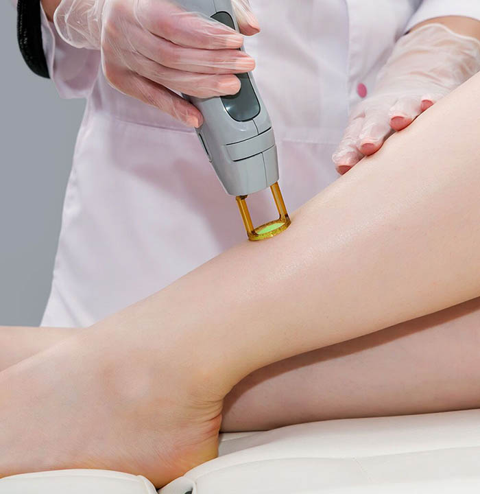 ویژگی‌های لیزر کل بدن در رویال سنتر