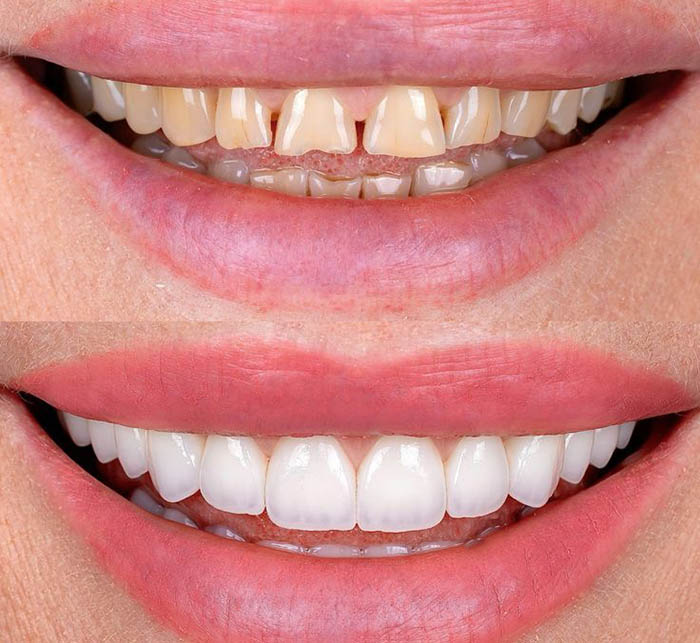 کامپوزیت در اسلامشهر