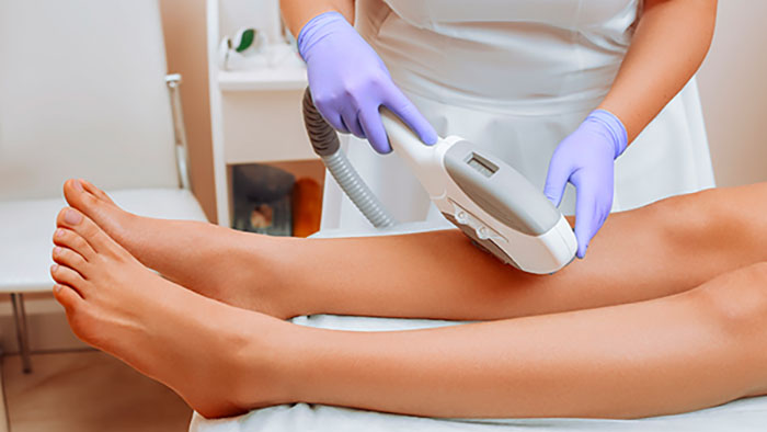 مزایای لیزر موهای زائد برای پوست‌های تیره در اسلامشهر